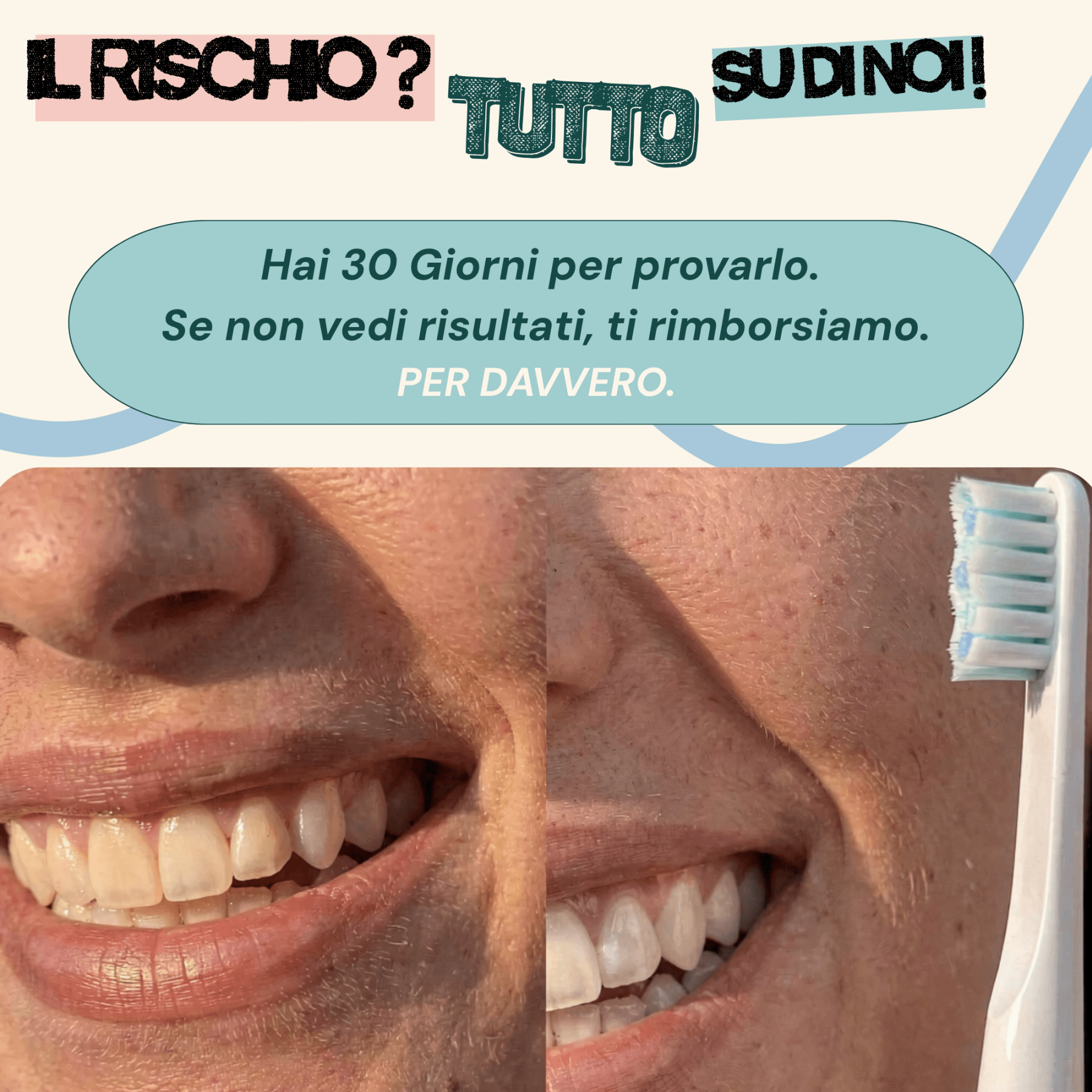 Zeta Fresh z1 - Spazzolino Sonico Elettrico | ZetaFresh